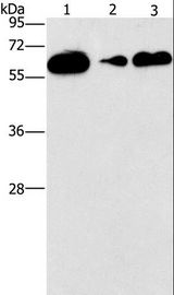 CD27 Antibody - Western blot analysis of Raji, PC3 and LOVO cell, using CD27 Polyclonal Antibody at dilution of 1:727.
