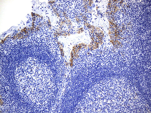 CD274 / B7-H1 / PD-L1 Antibody - Immunohistochemical staining of paraffin-embedded Human tonsil within the normal limits using anti-CD274. (PD-L1) mouse monoclonal antibody. (Heat-induced epitope retrieval by 1mM EDTA in 10mM Tris buffer. (pH9.0) at 120°C for 2.5 min. (1:300)