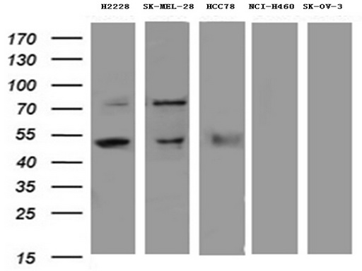 CD274 / B7-H1 / PD-L1 Antibody - Western blot analysis of extracts. (35ug) from 5 different cancer cell lines by using anti-CD274 monoclonal antibody. (1:500)