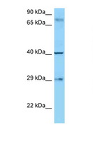 CD274 / B7-H1 / PD-L1 Antibody - CD274 / B7-H1 antibody Western blot of 8226 Cell lysate. Antibody concentration 1 ug/ml.  This image was taken for the unconjugated form of this product. Other forms have not been tested.