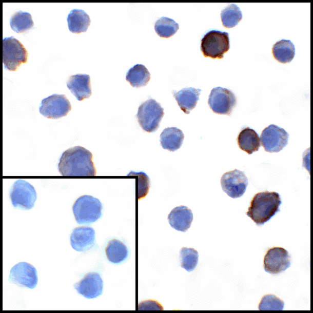 CD274 / B7-H1 / PD-L1 Antibody - Immunocytochemistry of PD-L1 in transfected HEK293 cells with PD-L1 antibody at 1 ug/mL. Lower left: Immunocytochemistry in transfected HEK293 cells with control mouse IgG antibody at 1 ug/mL.