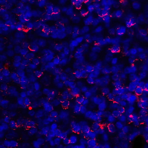 CD274 / B7-H1 / PD-L1 Antibody - Immunofluorescence of PD-L1 in human tonsil tissue with PD-L1 antibody at 2 ug/mL. Red: PDL1 Antibody [1F11] Blue: DAPI staining