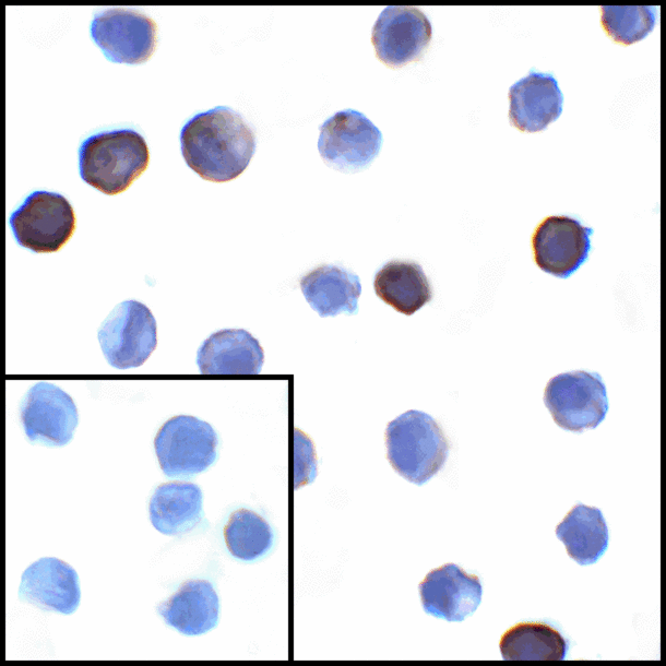 CD274 / B7-H1 / PD-L1 Antibody - Immunocytochemistry of PD-L1 in transfected HEK293 cells with PD-L1 antibody at 1 ug/mL. Lower left: Immunocytochemistry in transfected HEK293 cells with control mouse IgG antibody at 1 ug/mL.