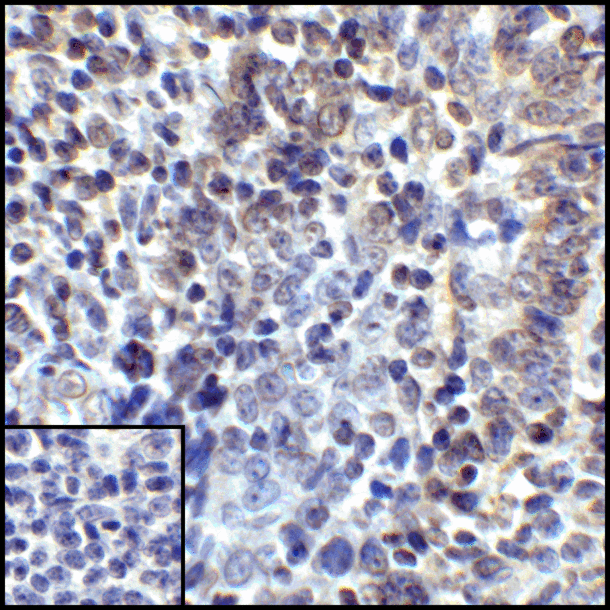 CD274 / B7-H1 / PD-L1 Antibody - Immunohistochemistry of PD-L1 in human tonsil tissue with PD-L1 antibody at 5 ug/mL.