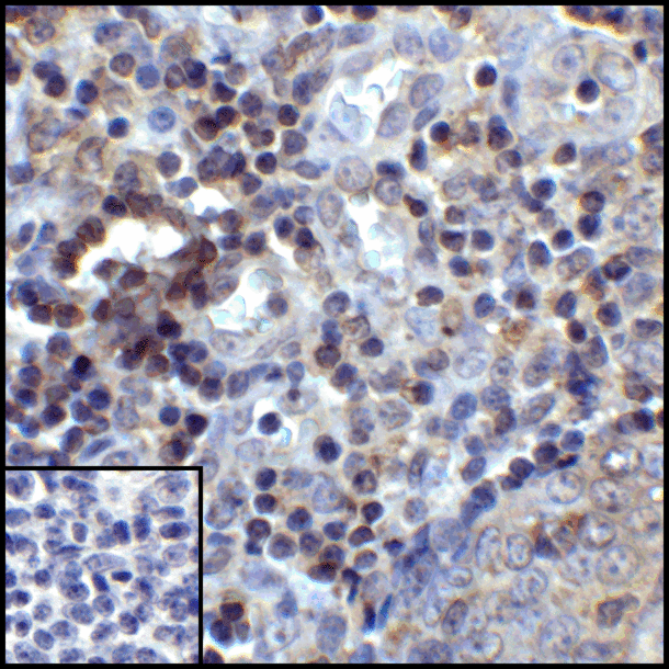 CD274 / B7-H1 / PD-L1 Antibody - Immunohistochemistry of PD-L1 in human tonsil tissue with PD-L1 antibody at 5 ug/mL.