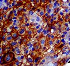 CD274 / B7-H1 / PD-L1 Antibody - IHC of HPV on FFPE LSIL of the Cervix. This image was taken for the unmodified form of this product. Other forms have not been tested.