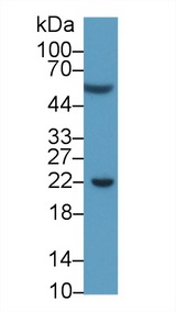 CD274 / B7-H1 / PD-L1 Antibody - Western Blot; Sample: Human Serum; Primary Ab: 2µg/ml Mouse Anti-Human PDCD1LG1 Antibody Second Ab: 0.2µg/mL HRP-Linked Caprine Anti-Mouse IgG Polyclonal Antibody