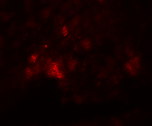 CD274 / B7-H1 / PD-L1 Antibody - Immunofluorescence of PD-L1 in Human Heart cells with PD-L1 antibody at 20 ug/mL.