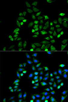CD274 / B7-H1 / PD-L1 Antibody - Immunofluorescence analysis of HeLa cells using CD274 antibody. Blue: DAPI for nuclear staining.