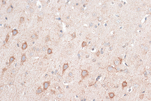 CD274 / B7-H1 / PD-L1 Antibody - Immunohistochemistry of paraffin-embedded rat brain using CD274 Antibody at dilution of 1:100 (40x lens).