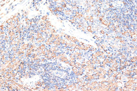 CD274 / B7-H1 / PD-L1 Antibody - Immunohistochemistry of paraffin-embedded rat spleen using CD274 Antibody at dilution of 1:100 (40x lens).