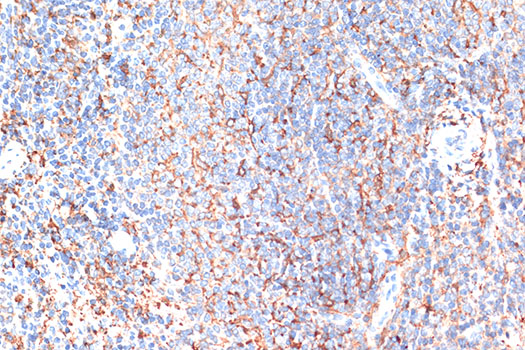 CD274 / B7-H1 / PD-L1 Antibody - Immunohistochemistry of paraffin-embedded mouse spleen using CD274 Antibody at dilution of 1:100 (40x lens).