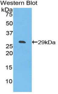 CD275 / B7-H2 / ICOS Ligand Antibody - Western blot of recombinant ICOSLG / ICOSL / ICOS Ligand.  This image was taken for the unconjugated form of this product. Other forms have not been tested.