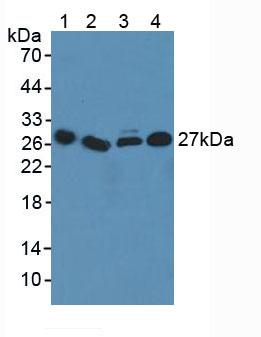 CD275 / B7-H2 / ICOS Ligand Antibody - Western Blot; Sample: Lane1: Human Serum; Lane2: Human Liver Tissue; Lane3: Human Lung Tissue; Lane4: Human Jurkat Cells.