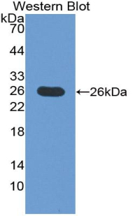 CD275 / B7-H2 / ICOS Ligand Antibody - Western blot of recombinant ICOSLG / ICOSL / ICOS Ligand.