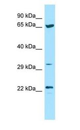 CD275 / B7-H2 / ICOS Ligand Antibody - ICOSLG / ICOSL / ICOS Ligand antibody Western Blot of ACHN.  This image was taken for the unconjugated form of this product. Other forms have not been tested.