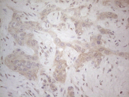 CD275 / B7-H2 / ICOS Ligand Antibody - Immunohistochemical staining of paraffin-embedded Human liver tissue within the normal limits using anti-ICOSLG mouse monoclonal antibody. (Heat-induced epitope retrieval by 1mM EDTA in 10mM Tris buffer. (pH8.5) at 120°C for 3 min. (1:150)