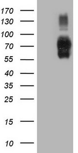 CD275 / B7-H2 / ICOS Ligand Antibody - HEK293T cells were transfected with the pCMV6-ENTRY control. (Left lane) or pCMV6-ENTRY ICOSLG. (Right lane) cDNA for 48 hrs and lysed
