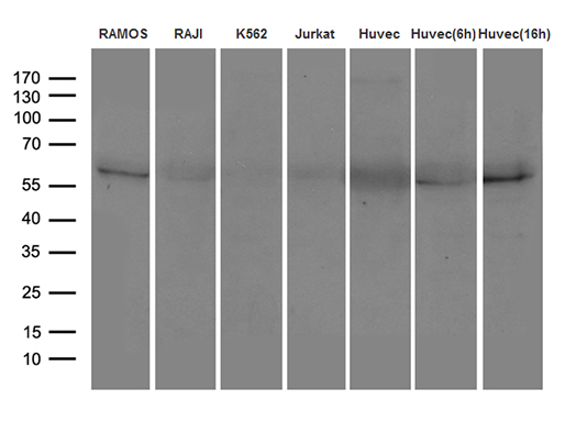 CD275 / B7-H2 / ICOS Ligand Antibody - Western blot analysis of 35ug lysates of Ramos, Raji, K562, Jurkat cell lines and TNF-a recombinant protein. (100ng/ml, sitimulated HUVEC cells for 0h,6h and 16h. (1:500)