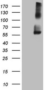 CD275 / B7-H2 / ICOS Ligand Antibody - HEK293T cells were transfected with the pCMV6-ENTRY control. (Left lane) or pCMV6-ENTRY ICOSLG. (Right lane) cDNA for 48 hrs and lysed. Equivalent amounts of cell lysates. (5 ug per lane) were separated by SDS-PAGE and immunoblotted with anti-ICOSLG. (1:2000)