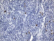 CD275 / B7-H2 / ICOS Ligand Antibody - Immunohistochemical staining of paraffin-embedded Human lymph node tissue within the normal limits using anti-ICOSLG. (B7H2, CD275) mouse monoclonal antibody. (Heat-induced epitope retrieval by 1mM EDTA in 10mM Tris buffer. (pH8.0) at 120°C for 2.5 min. (1:300)