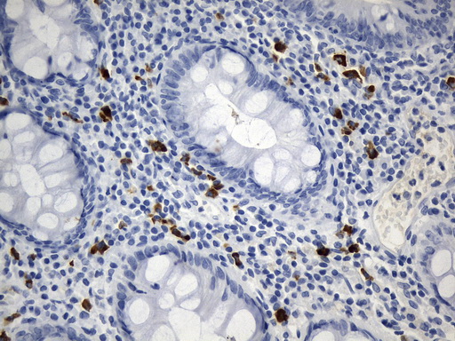 CD275 / B7-H2 / ICOS Ligand Antibody - Immunohistochemical staining of paraffin-embedded Human colon tissue within the normal limits using anti-ICOSLG. (B7H2, CD275) mouse monoclonal antibody. (Heat-induced epitope retrieval by 1mM EDTA in 10mM Tris buffer. (pH8.0) at 120°C for 2.5 min. (1:300)