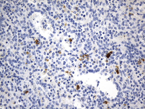 CD275 / B7-H2 / ICOS Ligand Antibody - Immunohistochemical staining of paraffin-embedded Human spleen tissue within the normal limits using anti-ICOSLG. (B7H2, CD275) mouse monoclonal antibody. (Heat-induced epitope retrieval by 1mM EDTA in 10mM Tris buffer. (pH8.0) at 120°C for 2.5 min. (1:300)