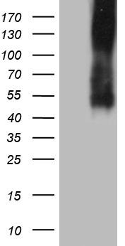 CD275 / B7-H2 / ICOS Ligand Antibody - HEK293T cells were transfected with the pCMV6-ENTRY control. (Left lane) or pCMV6-ENTRY ICOSLG. (B7H2, CD275). (Right lane) cDNA for 48 hrs and lysed. Equivalent amounts of cell lysates. (5 ug per lane) were separated by SDS-PAGE and immunoblotted with anti-ICOSLG. (B7H2, CD275). (1:1000)