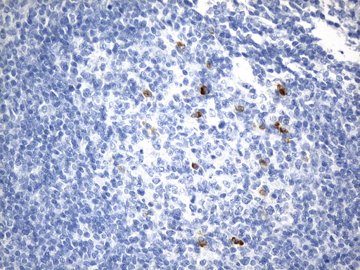 CD275 / B7-H2 / ICOS Ligand Antibody - Immunohistochemical staining of paraffin-embedded Human tonsil within the normal limits using anti-ICOSLG. (B7H2, CD275) mouse monoclonal antibody. (Heat-induced epitope retrieval by 1mM EDTA in 10mM Tris buffer. (pH8.0) at 120°C for 2.5 min. (1:300)