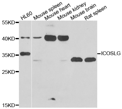 CD275 / B7-H2 / ICOS Ligand Antibody - Western blot analysis of extracts of various cell lines.
