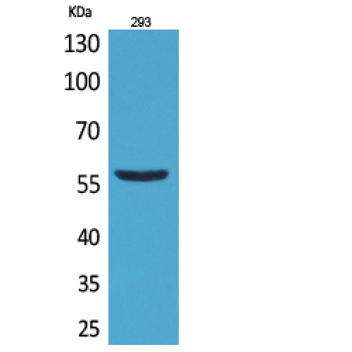 CD276 / B7-H3 Antibody - Western blot of CD276 antibody