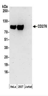 CD276 / B7-H3 Antibody - Detection of Human CD276 by Western Blot. Samples: Whole cell lysate (50 ug) prepared using NETN buffer from HeLa, 293T, and Jurkat cells. Antibodies: Affinity purified rabbit anti-CD276 antibody used for WB at 0.1 ug/ml. Detection: Chemiluminescence with an exposure time of 3 minutes.