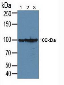 CD276 / B7-H3 Antibody - Western Blot; Sample: Lane1: Human 293T Cells; Lane2: Human PC-3 Cells; Lane3: Human MCF-7 Cells.