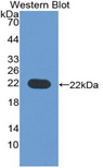 CD276 / B7-H3 Antibody - Western blot of recombinant CD276 / B7-H3.