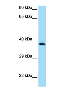 CD276 / B7-H3 Antibody - CD276 / B7-H3 antibody Western blot of MCF7 Cell lysate. Antibody concentration 1 ug/ml.  This image was taken for the unconjugated form of this product. Other forms have not been tested.