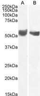 CD276 / B7-H3 Antibody - Goat anti-B7-H3 / CD276 Antibody (0.1µg/ml) staining of Human Placenta (A) and (2ug/ml) Testes (B) lysate (35µg protein in RIPA buffer). Primary incubation was 1 hour. Detected by chemiluminescencence.
