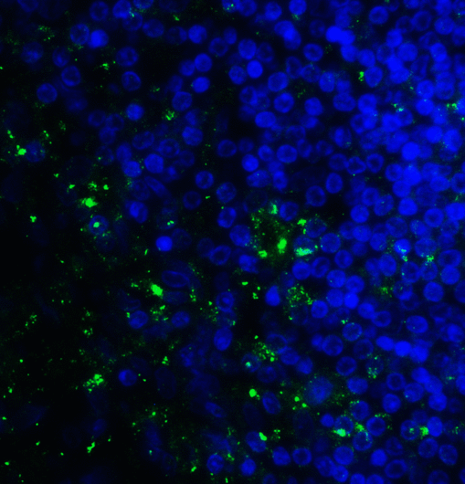 CD276 / B7-H3 Antibody - Immunofluorescence of B7-H3 in human colon carcinoma tissue cells using B7-H3 Antibody at 10 ug/ml. Green: B7-H3 Antibody [10G6] Blue: DAPI staining
