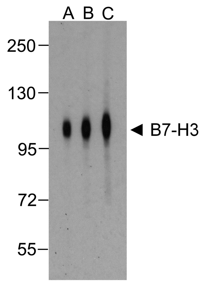 CD276 / B7-H3 Antibody - Western blot analysis of B7-H3 in HEK293 cells using B7-H3 antibody at (A) 0.25 (B) 0.5 and (C) 1 ug/ml.