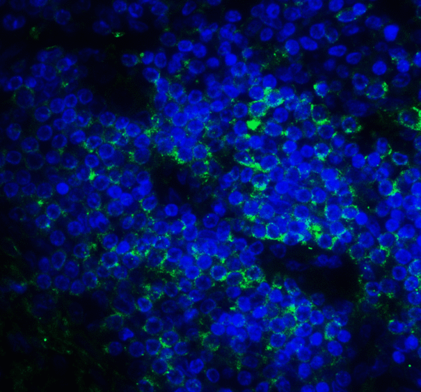 CD276 / B7-H3 Antibody - Immunofluorescence of B7-H3 in human colon carcinoma tissue cells using B7-H3 Antibody at 10 ug/ml. Green: B7-H3 Antibody [4H3] Blue: DAPI staining