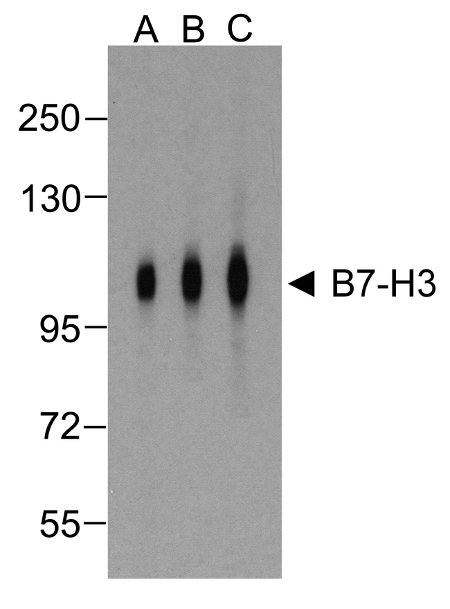 CD276 / B7-H3 Antibody - Western blot analysis of B7-H3 in HEK293 cells using B7-H3 antibody at (A) 0.25 (B) 0.5 and (C) 1 ug/ml.