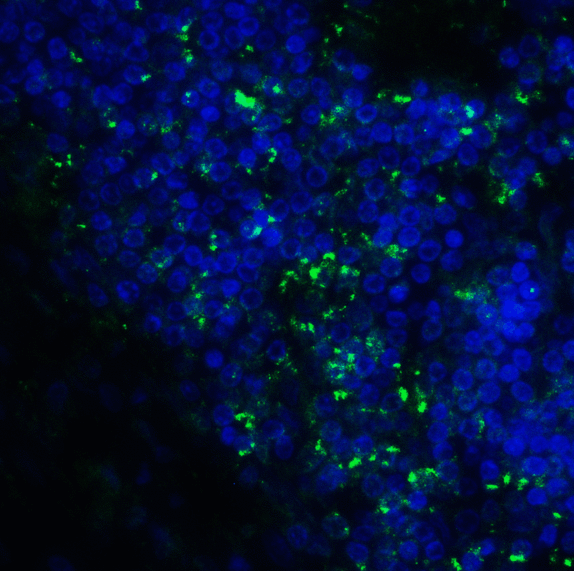 CD276 / B7-H3 Antibody - Immunofluorescence of B7-H3 in human colon carcinoma tissue cells using B7-H3 Antibody at 10 ug/ml. Green: B7-H3 Antibody [7B3] Blue: DAPI staining