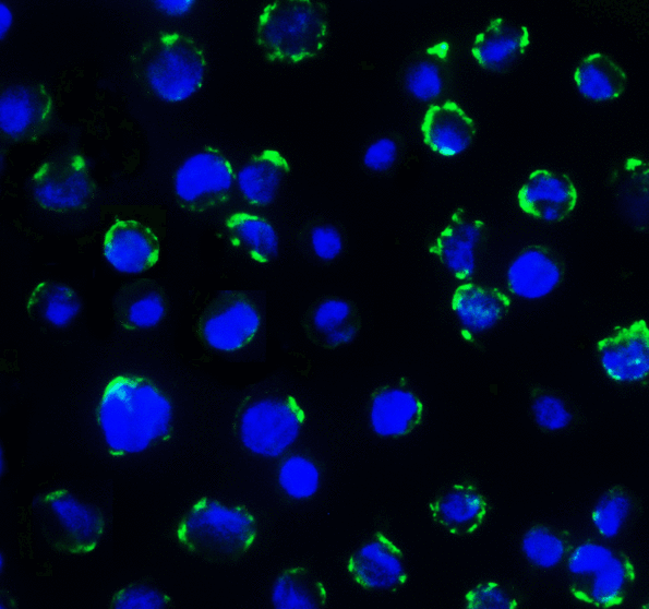 CD276 / B7-H3 Antibody - Immunofluorescence of B7-H3 in HEK293 cells using B7-H3 Antibody at 5 ug/ml. Green: B7-H3 Antibody [7B3] Blue: DAPI staining