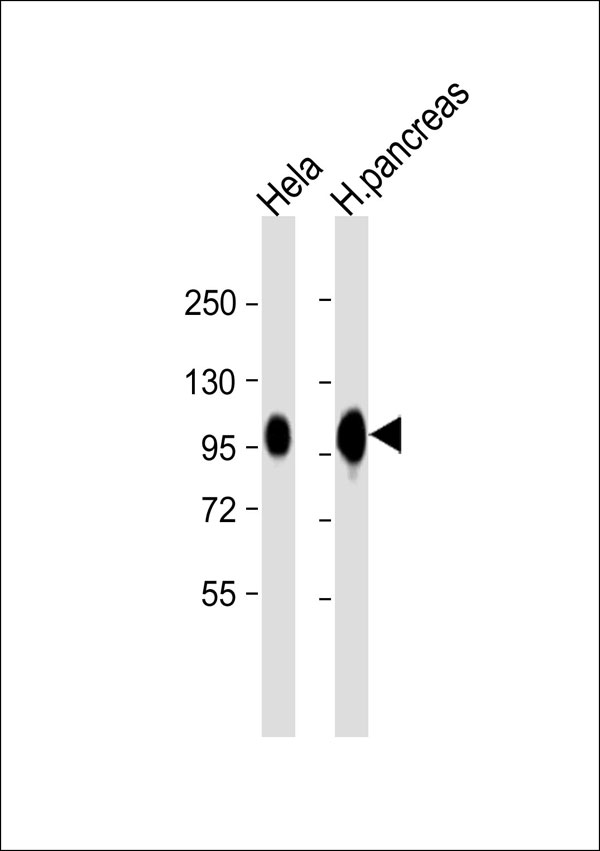 CD276 / B7-H3 Antibody - All lanes: Anti-CD276 Antibody at 1:4000 dilution. Lane 1: HeLa whole cell lysate. Lane 2: human pancreas lysate Lysates/proteins at 20 ug per lane. Secondary Goat Anti-Rabbit IgG, (H+L), Peroxidase conjugated at 1:10000 dilution. Predicted band size: 57 kDa. Blocking/Dilution buffer: 5% NFDM/TBST.