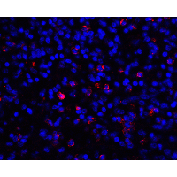 CD276 / B7-H3 Antibody - Immunofluorescence of CD276 in human spleen tissue with CD276 antibody at 20 µg/ml.
