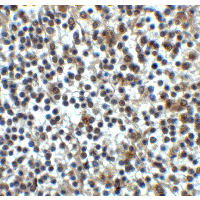 CD276 / B7-H3 Antibody - Immunohistochemistry of CD276 in human spleen tissue with CD276 antibody at 2 µg/ml.