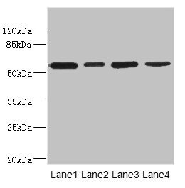 CD276 / B7-H3 Antibody - Western blot All Lanes: CD276 antibody at 0.48ug/ml Lane 1: U251 whole cell lysate Lane 2: Jurkat whole cell lysate Lane 3: HepG-2 whole cell lysate Lane 4: 293T whole cell lysate Secondary Goat polyclonal to rabbit IgG at 1/10000 dilution Predicted band size: 58,34,53 kDa Observed band size: 57 kDa