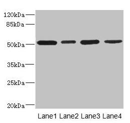 CD276 / B7-H3 Antibody - Western blot All lanes: CD276 antibody at 0.48µg/ml Lane 1: U251 whole cell lysate Lane 2: Jurkat whole cell lysate Lane 3: HepG2 whole cell lysate Lane 4: 293T whole cell lysate Secondary Goat polyclonal to rabbit IgG at 1/10000 dilution Predicted band size: 58, 34, 53 kDa Observed band size: 53 kDa