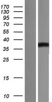 CD276 / B7-H3 Protein - Western validation with an anti-DDK antibody * L: Control HEK293 lysate R: Over-expression lysate
