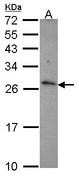 CD27L / CD70 Antibody - Sample (30 ug of whole cell lysate). A: JurKat. 12% SDS PAGE. CD27L (CD70) antibody. CD70 antibody diluted at 1:1000.