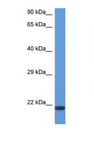 CD27L / CD70 Antibody - CD70 antibody Western blot of ACHN Cell lysate. Antibody concentration 1 ug/ml.  This image was taken for the unconjugated form of this product. Other forms have not been tested.